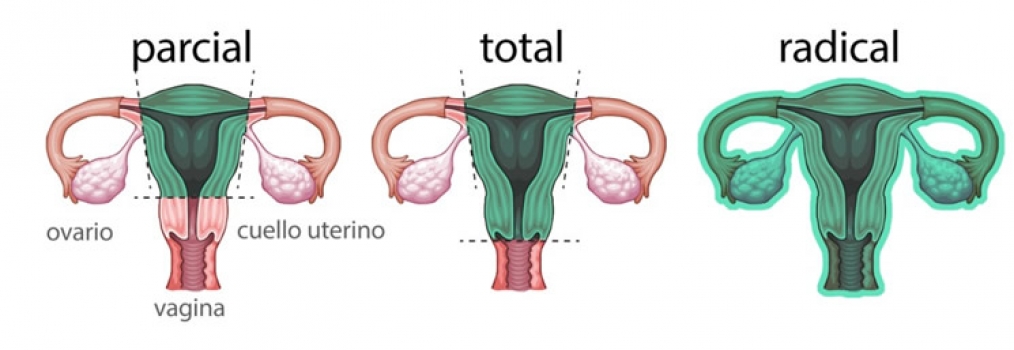 Trato genital feminino (colo uterino, ovrio, tero)